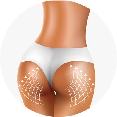 Антицеллюлитная сыворотка Beauty Booty Serum для ягодиц, 150 мл вид 3