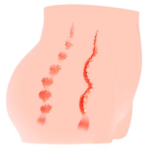 Мастурбатор полуторс Kokos Cherry вагіна та попка вид 4