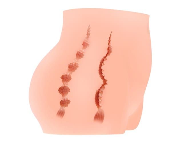 Мастурбатор полуторс Kokos Cherry, два входа: вагина и попка с вибрацией вид 4